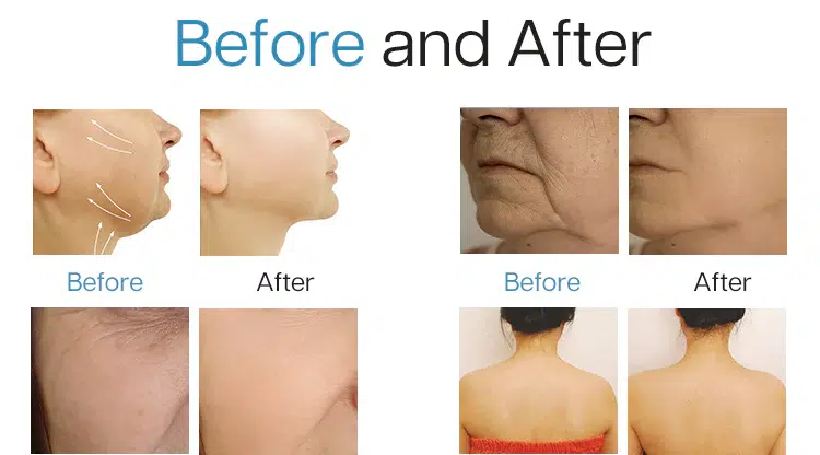 EF20__10 (3) EF20 10 3